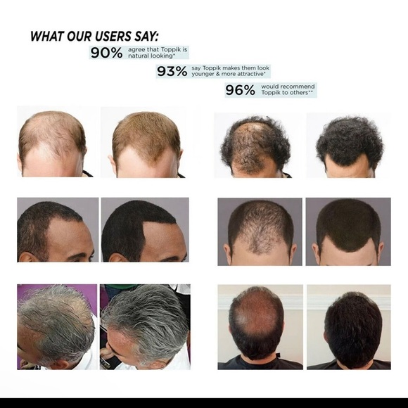 Toppik hair fibers 27.5 g black dark brown medium blonde black   3 bottl… - Picture 4 of 12